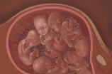 胎儿NT检测的意义及方法