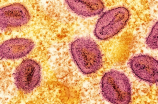 多国报告出现的猴痘是什么疾病?